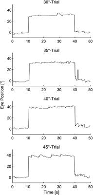 Prevalence and Characteristics of Physiological Gaze-Evoked and Rebound Nystagmus: Implications for Testing Their Pathological Counterparts